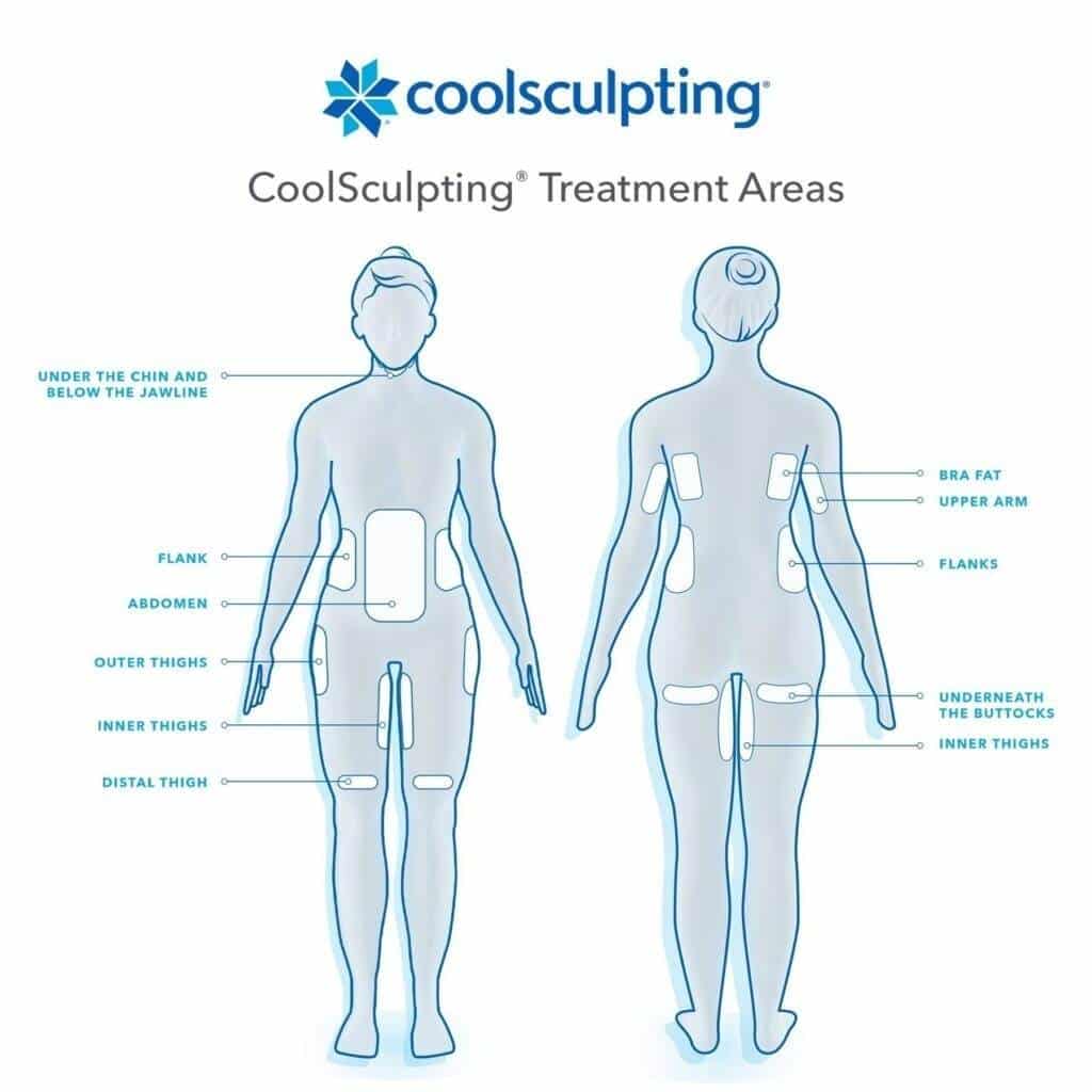 CoolSculpting Treatment Areas - Sculpted Contours - Atlanta, GA