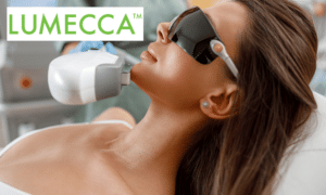 Lumecca IPL Skin Rejuvenation