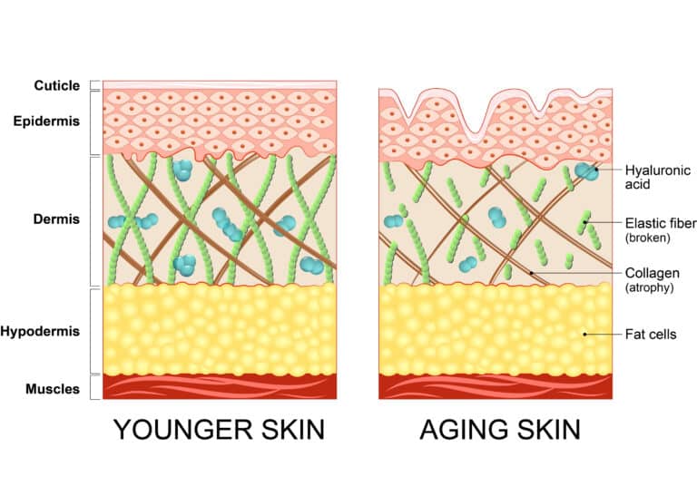 Collagen Loss in Aging Skin