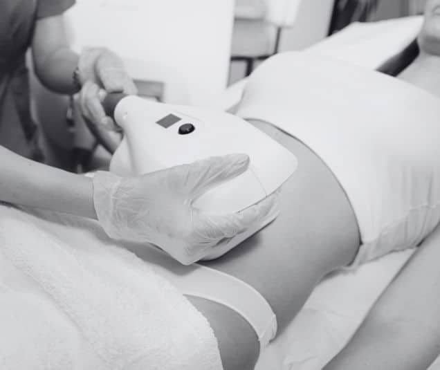 coolsculpting-treatment-details-alpharetta
