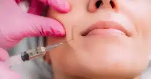 woman-receiving-dermal-filler-injection