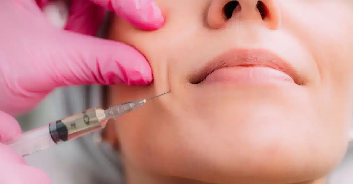 woman-receiving-dermal-filler-injection