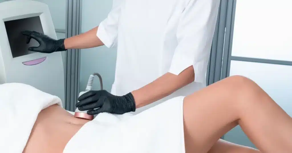 body-sculpting-device-treatment-on-skin-at-sculpted-contours-medspa