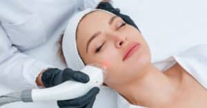 Morpheus8 device working on a woman's forehead for collagen stimulation and skin rejuvenation.