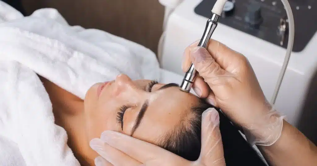 Morpheus8 procedure being performed on a woman’s face for skin tightening and smoothing.