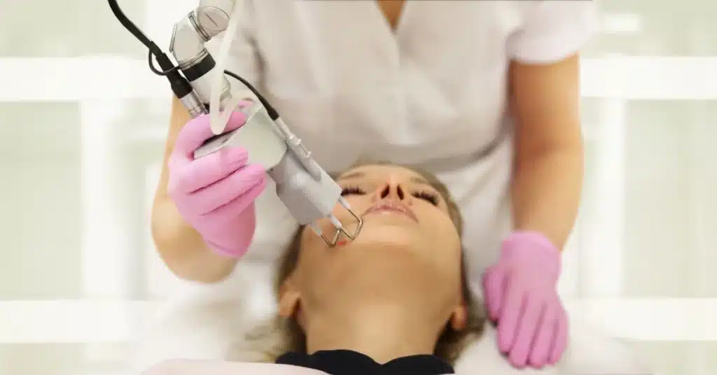 Morpheus8 treatment being applied to a woman's face for skin rejuvenation