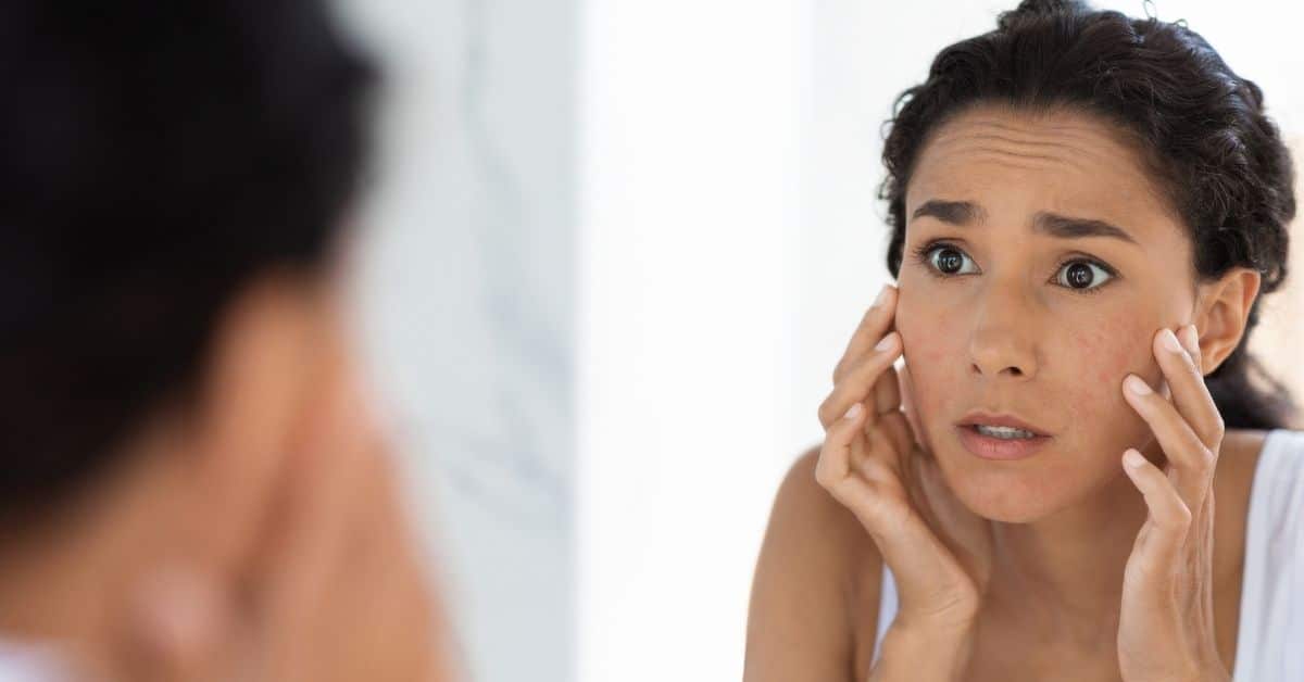 woman-looking-at-her-skin-with-a-concerned-expression-in-the-mirror - acne - skin - issue - closeup - considering-sculptra-treatment