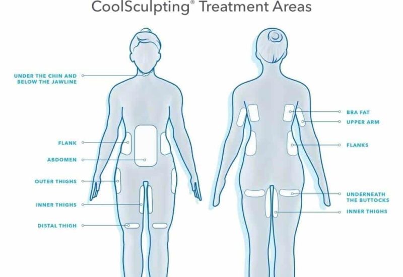 CoolSculpting-Treatment-Areas