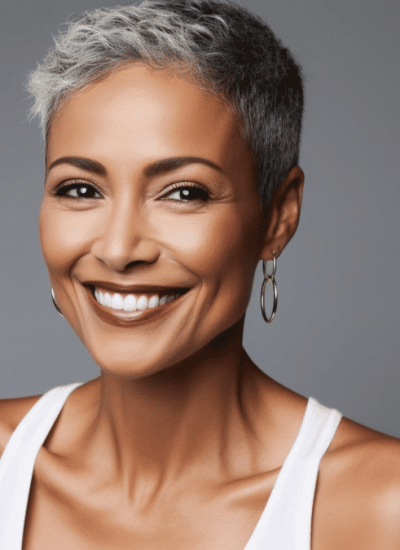 Smiling woman with glowing skin after Fractora RF Microneedling treatment for skin rejuvenation.